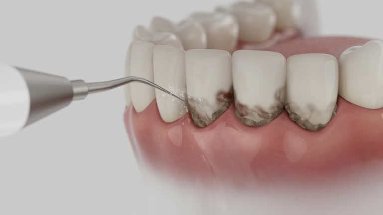 Trusted Tooth Extraction service in Burkburnett, TX - Dentist Open Now